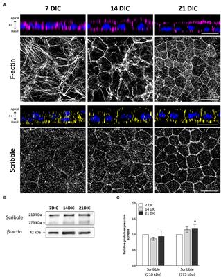 Scribble basal polarity acquisition in RPE cells and its mislocalization in a pathological AMD-like model